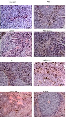 celulas del sistema inmune300.jpg